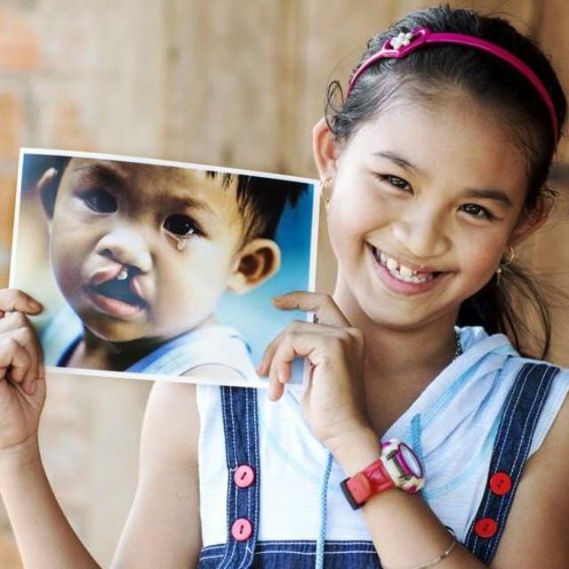 Donation to Operation Smile