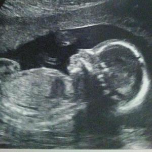 Jade Gormady And Michael Bernstein S Wedding Registry On Zola Zola